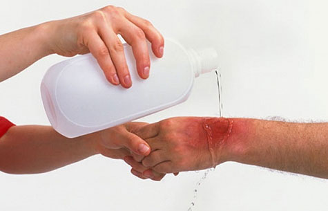 خمیردندان اثری در بهبودی ناحیه سوختگی ندارد